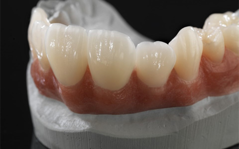 su-ceramill-zolid-5